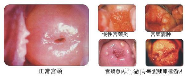 子宫里原来这么脏，想看子宫的看一次拉倒！ - moonca.ke - ~@粉色音符~