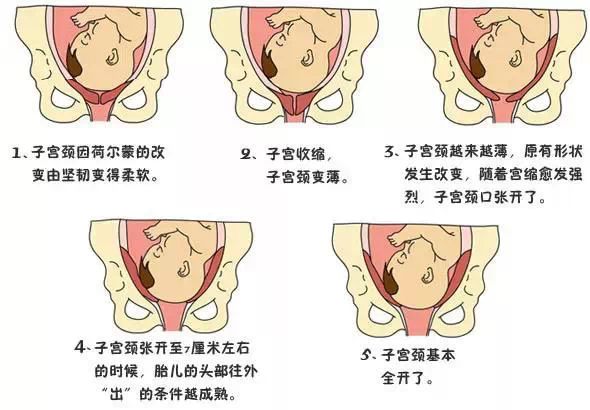 顾名思义,"产程"指的是自然分娩胎儿的过程.