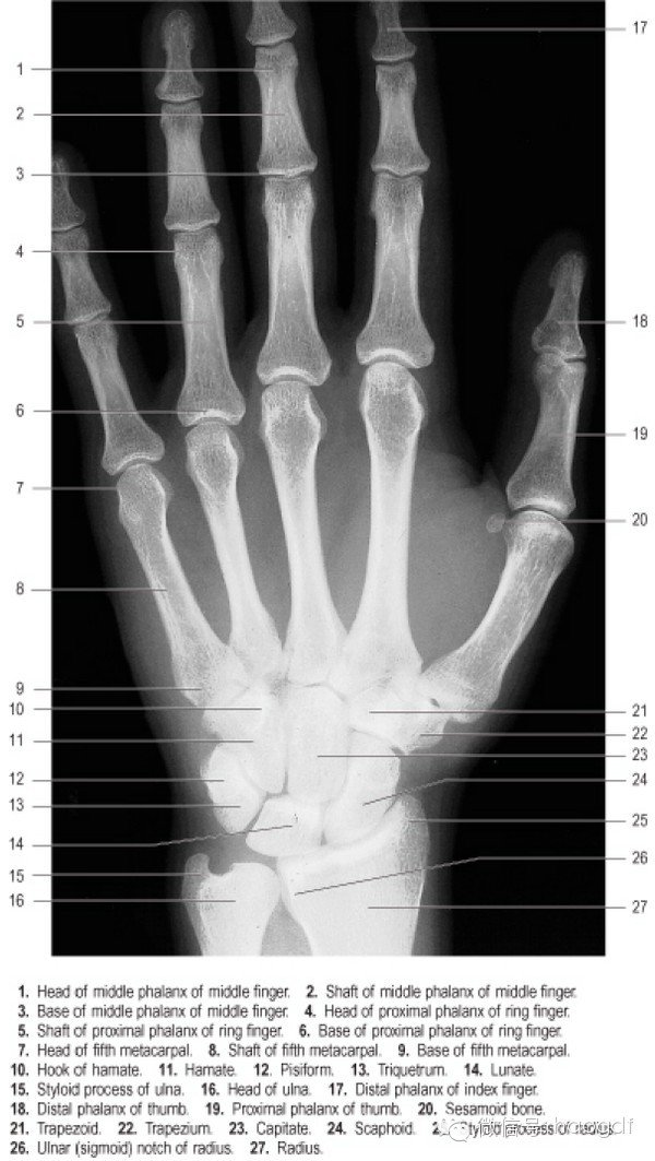 为什么小拇指会不由自主地翘起来？