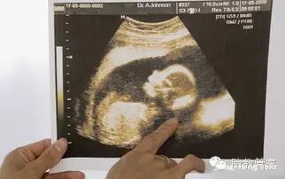 好孕课堂:怀孕初期B超,胎儿发育形态-怀孕期