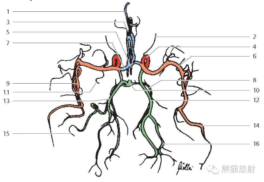 superior cerebellar artery 小脑上动脉 23 basilar artery 基底动脉