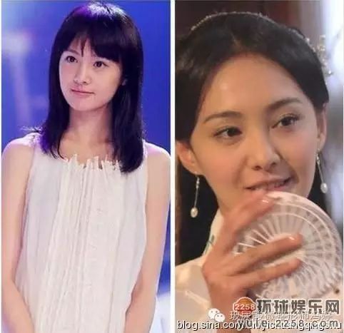 郑爽萧亚轩李多海 大方承认整容的女星