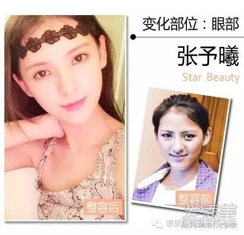 杨紫郑爽张予曦 告诉你90后女星整容都整了哪