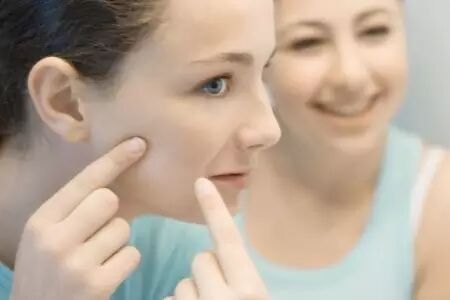 脂溢性皮炎的诊疗