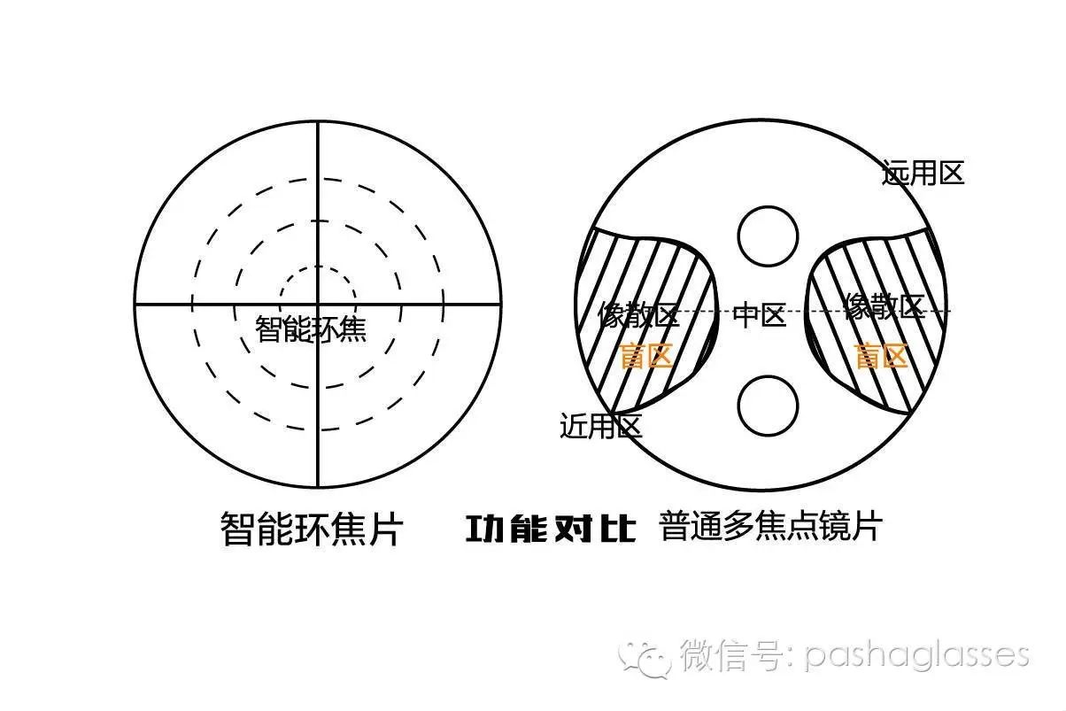 深度解析环焦点近视防控镜片