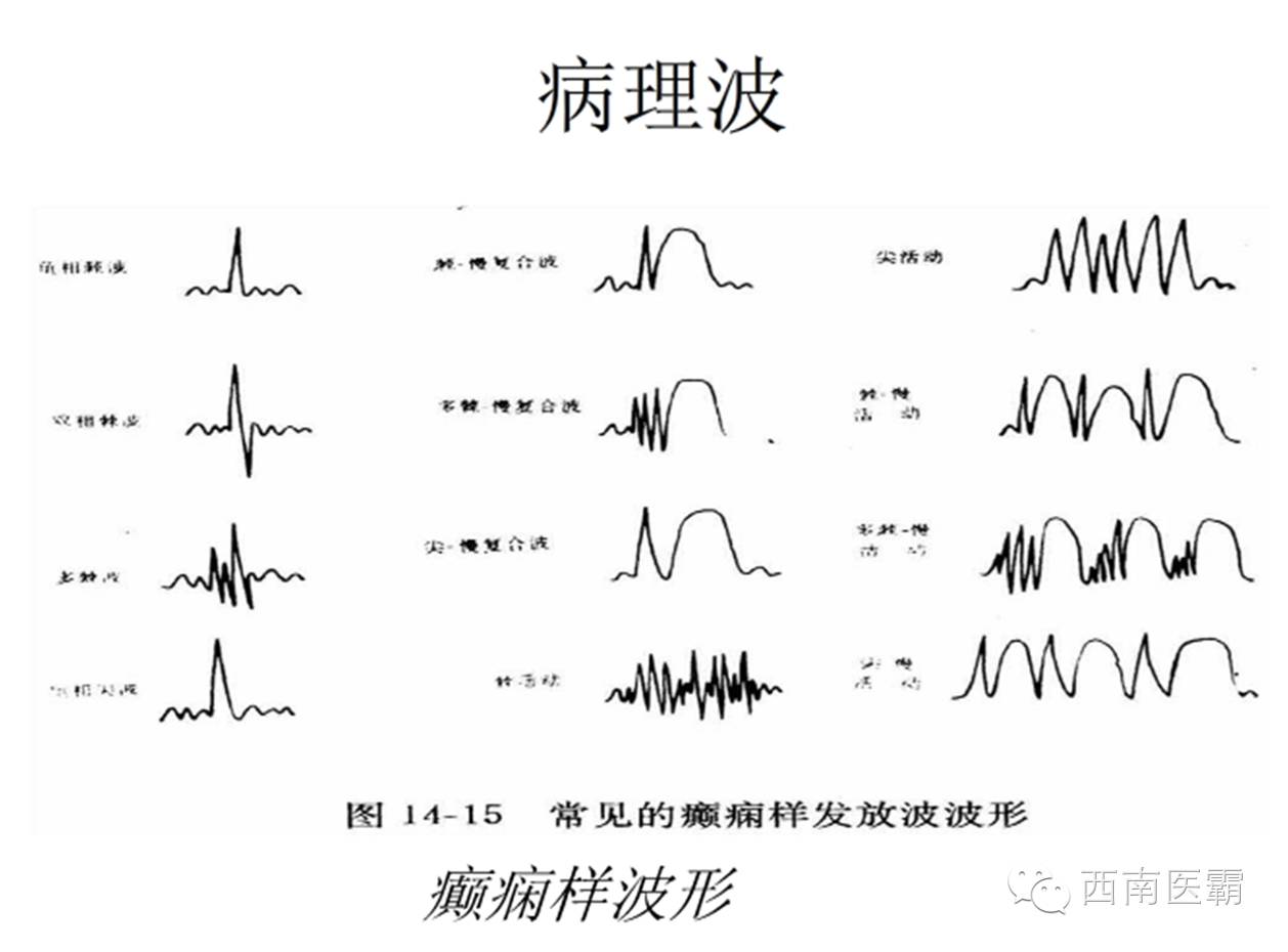 脑电和电脑有什么关系