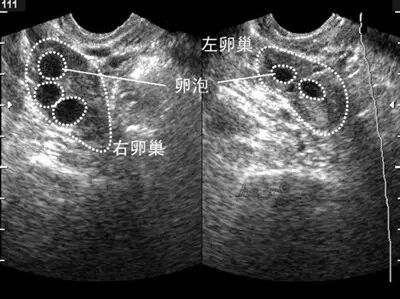 【备孕指南】有许多小卵子然而并没有什么用-怀孕期