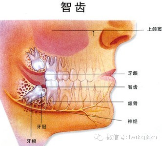 智齿常识