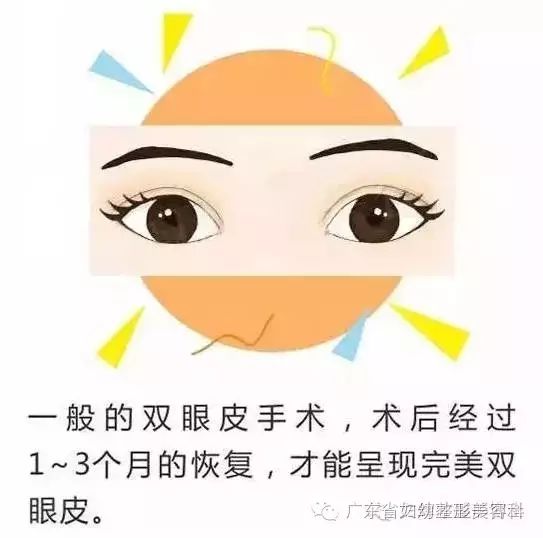 【健康知识】双眼皮术后护理的重要性,do you know?