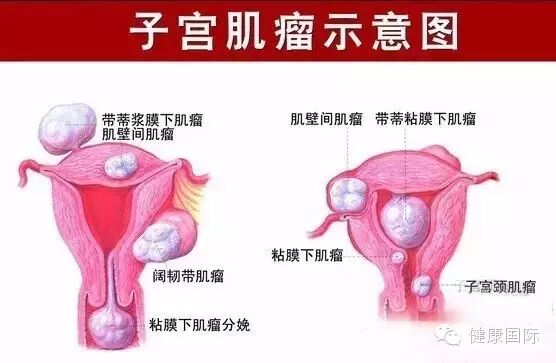 怀孕前要先要调理身体,尤其是有这些疾病的需注意!-怀孕期