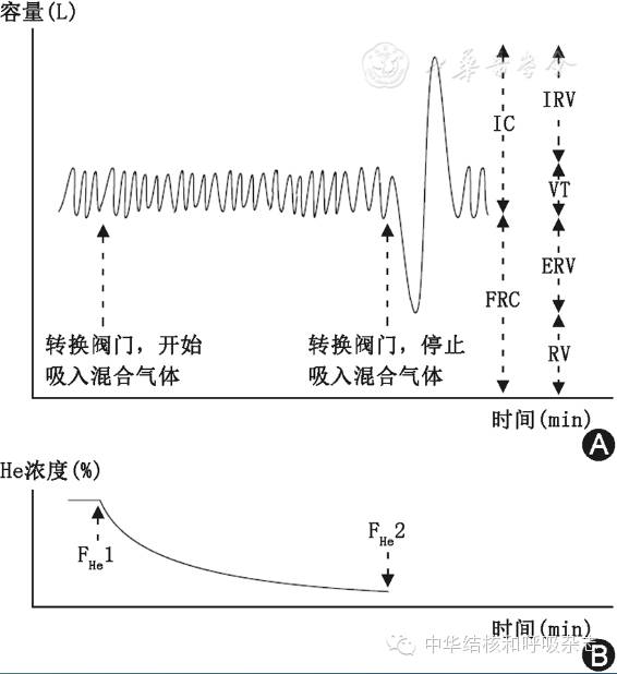 什么是气体陷闭【诊疗方案】肺功能检查指南––肺容量检查_https://www.jmylbn.com_新闻资讯_第6张