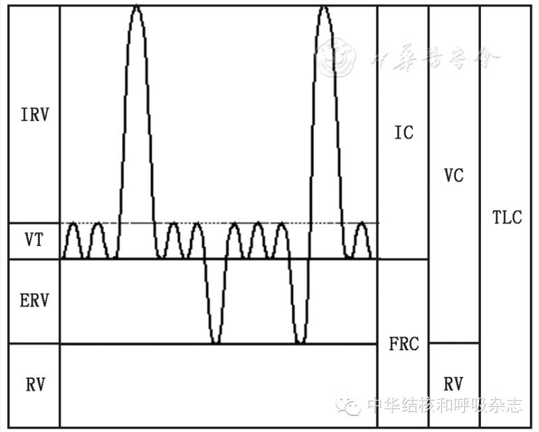 什么是气体陷闭【诊疗方案】肺功能检查指南––肺容量检查_https://www.jmylbn.com_新闻资讯_第2张