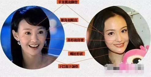 郑爽.李小璐.伊能静的双眼皮刀疤是这样造成的!