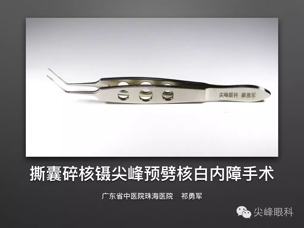 手术镊怎么尖峰眼科 ｜ 撕囊碎核镊尖峰预劈核白内障手术 祁勇军_https://www.jmylbn.com_新闻资讯_第2张