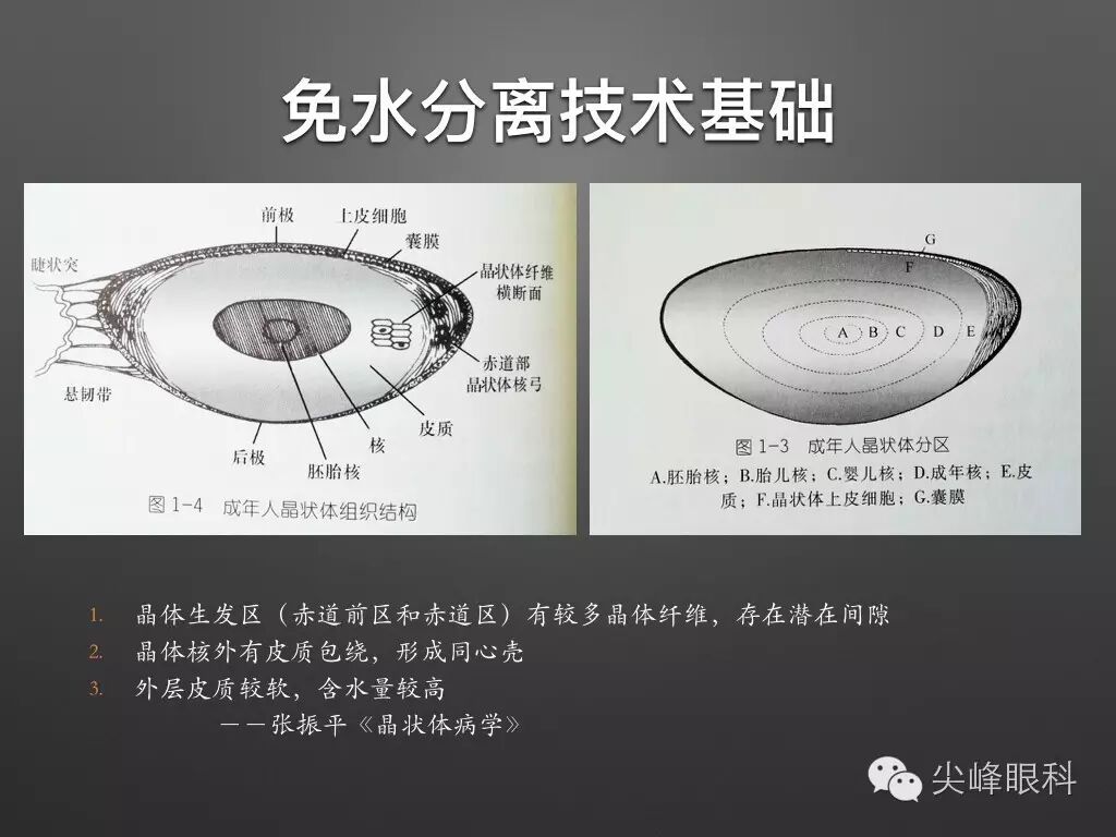 手术镊怎么尖峰眼科 ｜ 撕囊碎核镊尖峰预劈核白内障手术 祁勇军_https://www.jmylbn.com_新闻资讯_第14张