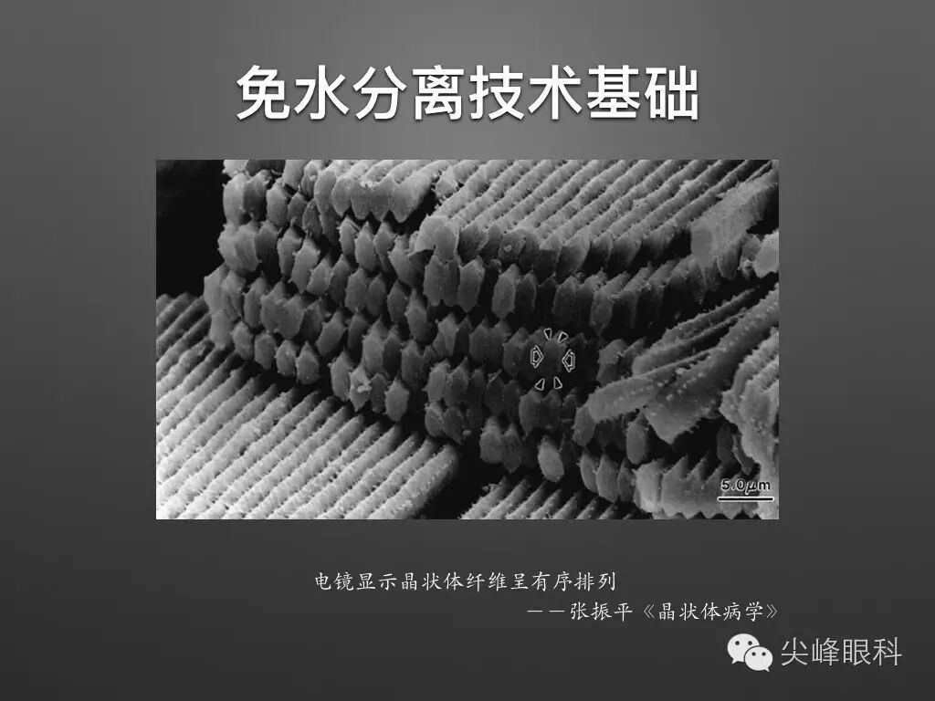 手术镊怎么尖峰眼科 ｜ 撕囊碎核镊尖峰预劈核白内障手术 祁勇军_https://www.jmylbn.com_新闻资讯_第15张