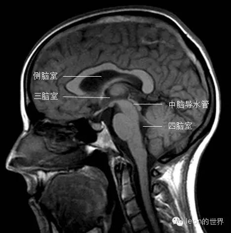 最全的脑室解剖图谱