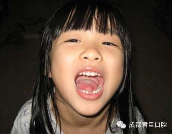 如果孩子患有鼻炎等疾病,鼻道不通畅,就会形成用嘴呼吸的习惯.