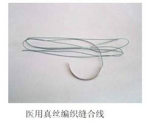 为什么手术不用可吸收线3分钟全面了解可吸收手术缝合线_https://www.jmylbn.com_新闻资讯_第3张