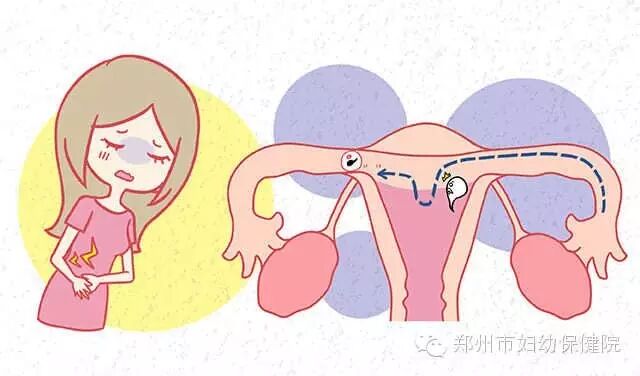 24岁女子怀孕6个多月,子宫里却是空的,宝宝究竟“去哪了”!-怀孕期