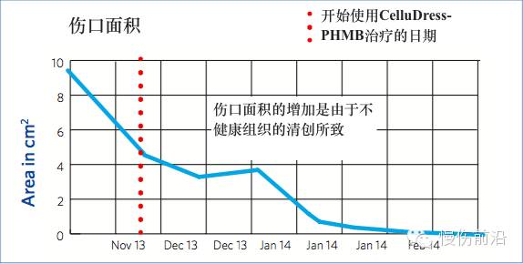 抗菌清创敷料有什么用PHMB在伤口感染治疗中的应用_https://www.jmylbn.com_新闻资讯_第10张