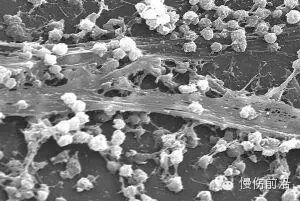 抗菌清创敷料有什么用PHMB在伤口感染治疗中的应用_https://www.jmylbn.com_新闻资讯_第1张