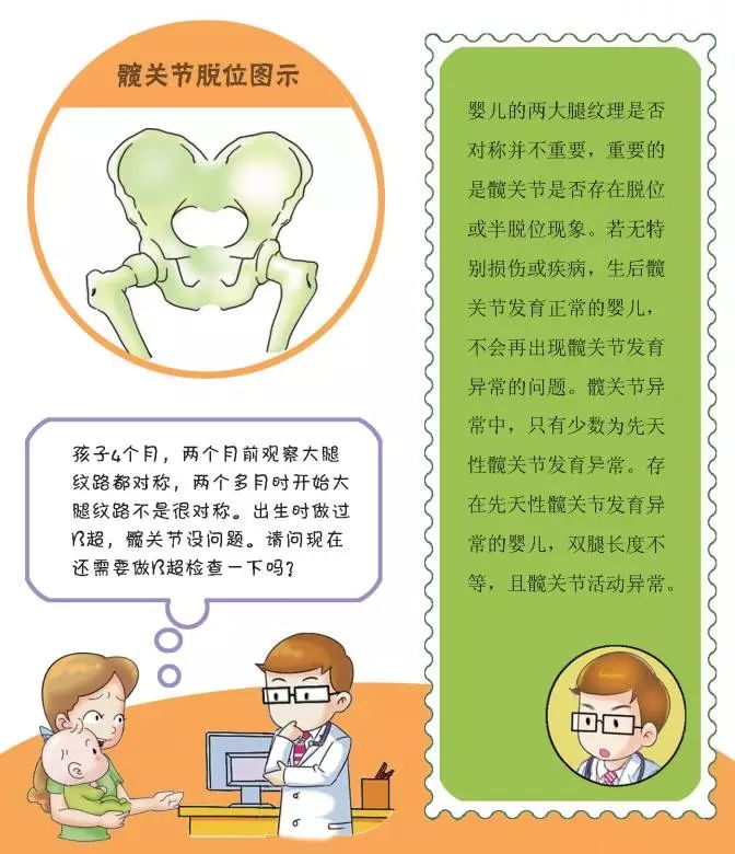 腿纹,臀纹不对称,不痛不痒提示注意髋关节脱位