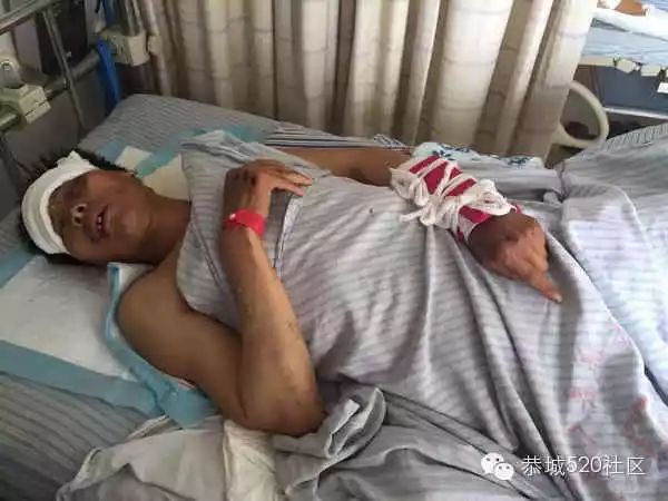 无良司机肇事逃逸,恭城栗矿街坊为受伤智障男子爱心捐款24 / 作者:箩筐索 / 帖子ID:115900 无良司机肇事逃逸,恭城栗矿街坊为受伤智障男子爱心捐款24 / 作者:箩筐索 / 帖子ID:115900