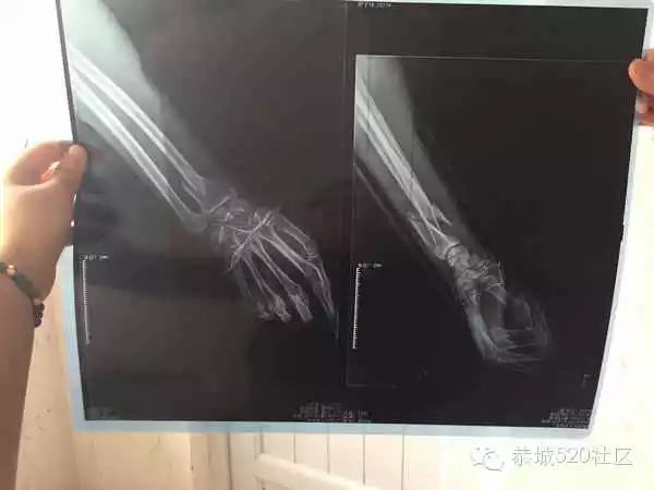 无良司机肇事逃逸,恭城栗矿街坊为受伤智障男子爱心捐款57 / 作者:箩筐索 / 帖子ID:115900 无良司机肇事逃逸,恭城栗矿街坊为受伤智障男子爱心捐款57 / 作者:箩筐索 / 帖子ID:115900