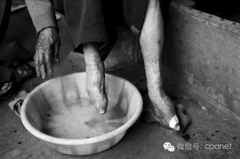 正在洗脚的小脚女人(云南 2002)