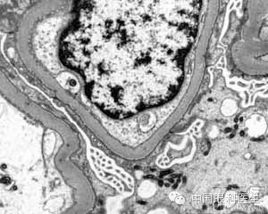 ��������Ĥ��������ۡ���ȫͼ�������ղء�