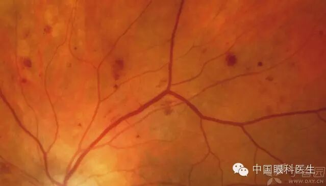 ��������Ĥ��������ۡ���ȫͼ�������ղء�