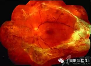 ��������Ĥ��������ۡ���ȫͼ�������ղء�