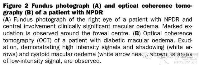 ��������Ĥ��������ۡ���ȫͼ�������ղء�