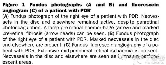 ��������Ĥ��������ۡ���ȫͼ�������ղء�