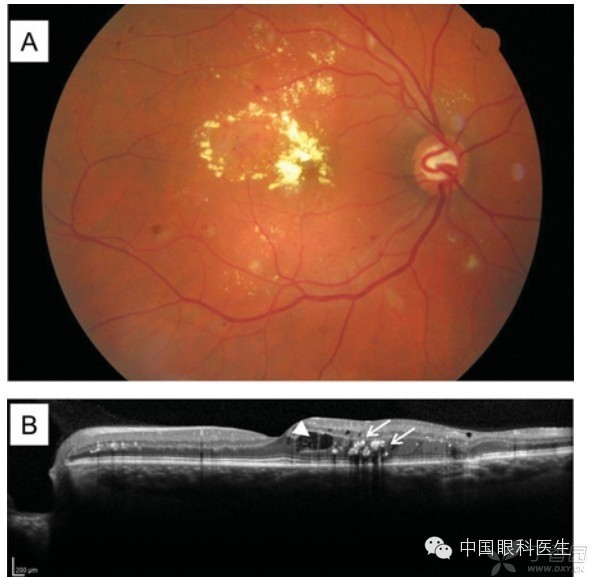 ��������Ĥ��������ۡ���ȫͼ�������ղء�