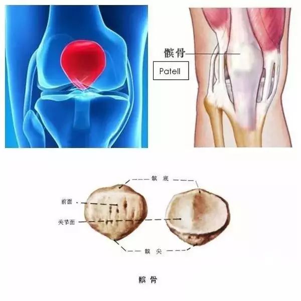(浅谈髌骨脱位)