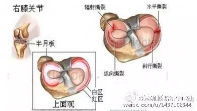 图说半月板之基础知识