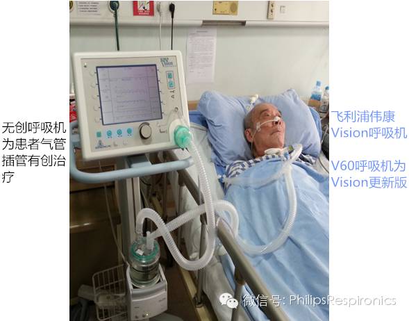 epap什么模式无创呼吸机（二）_https://www.jmylbn.com_新闻资讯_第29张