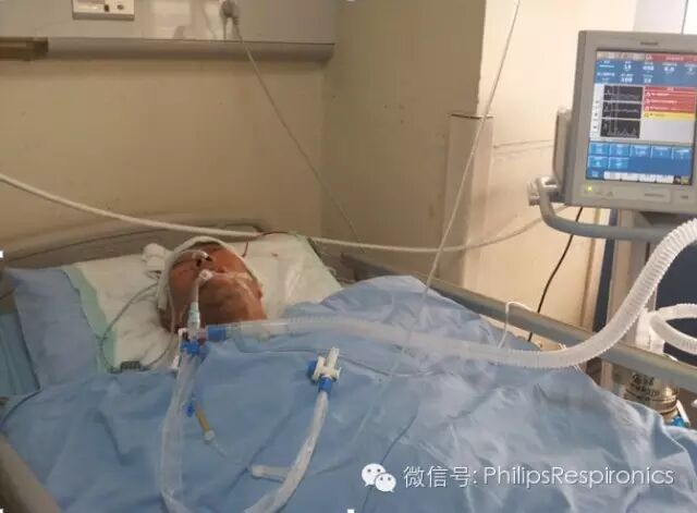 epap什么模式无创呼吸机（二）_https://www.jmylbn.com_新闻资讯_第26张
