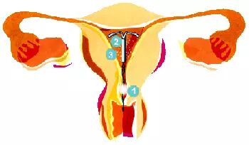 [网商爱华】子宫与健康----女人为了自己请收藏与分享！！ - 爱华 - 【网商爱华】王爱华老师