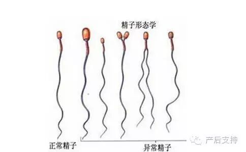【备孕】精液太多难怀孕 一次射精多于6毫升为多精液症-怀孕期