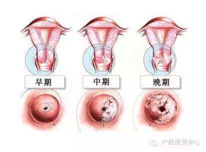 【备孕】常见妇科病的防治知识-怀孕期