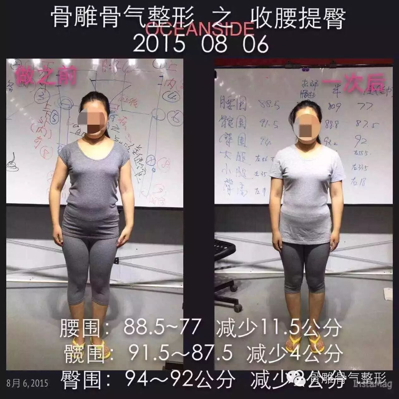 sky life 天活-楼台丰【骨雕骨气~整形.塑身.疼痛.