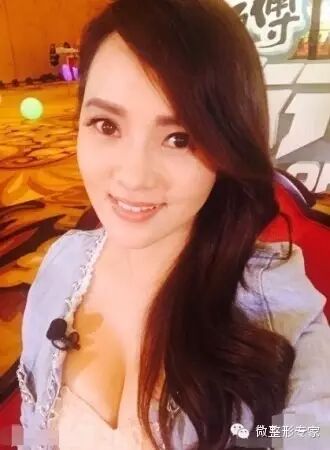 伊能静:46岁做水光,宛如20岁少女!