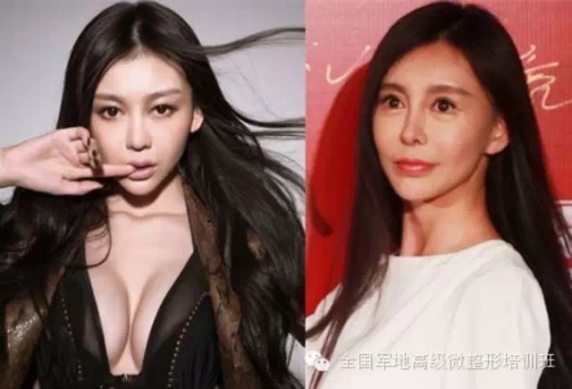 巩新亮毁容了!把自己整老了20岁……