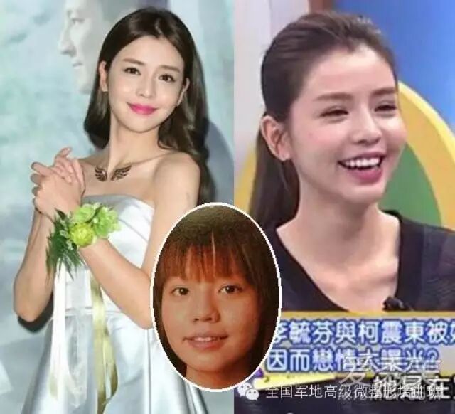 李毓芬整容前照片 丑女逆袭迷倒柯震东小猪