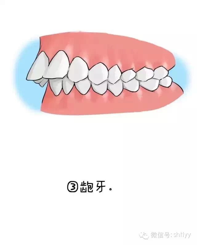 【天伦口腔】为啥要做牙齿矫正?萌萌哒的口腔漫画