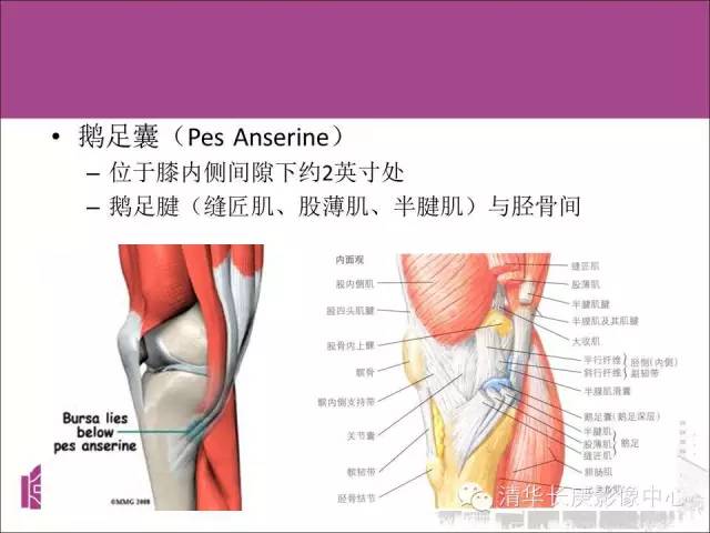 建议收藏膝关节周围滑囊及其病变