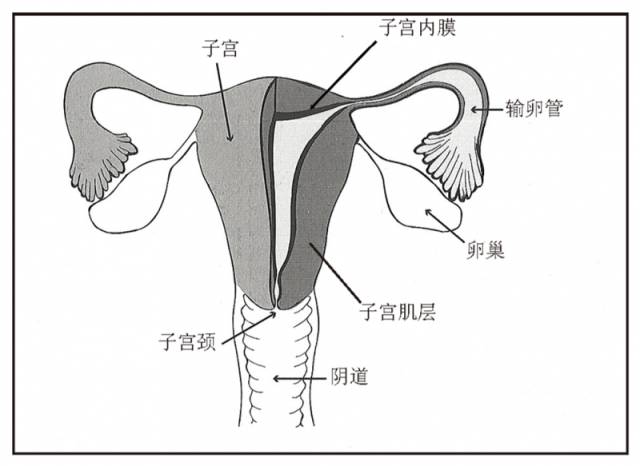 子宫内膜异位症到底是怎么回事